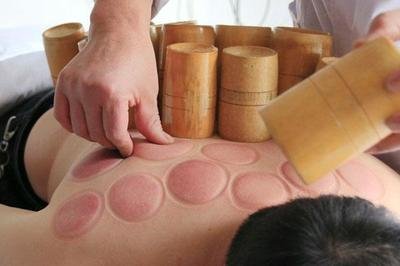 拔火罐注意事项