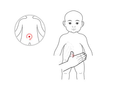 小儿推拿治疗感冒吗？
