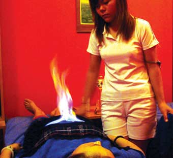 火疗常识的注意事项