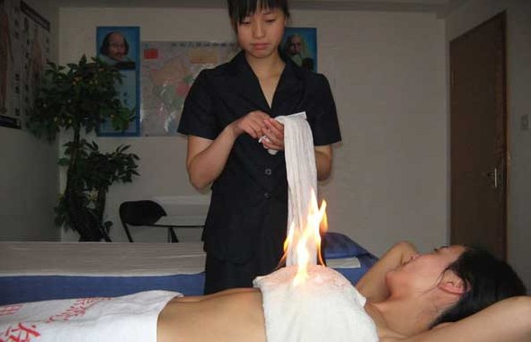 中医:火疗保健养生的功效
